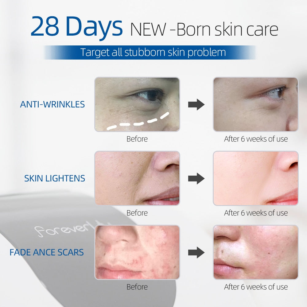 Acne Removal Anti Wrinkle